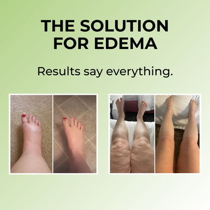 Lonava™ Miracle Balm