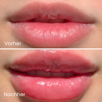Normal & Extreme Lip Plumper